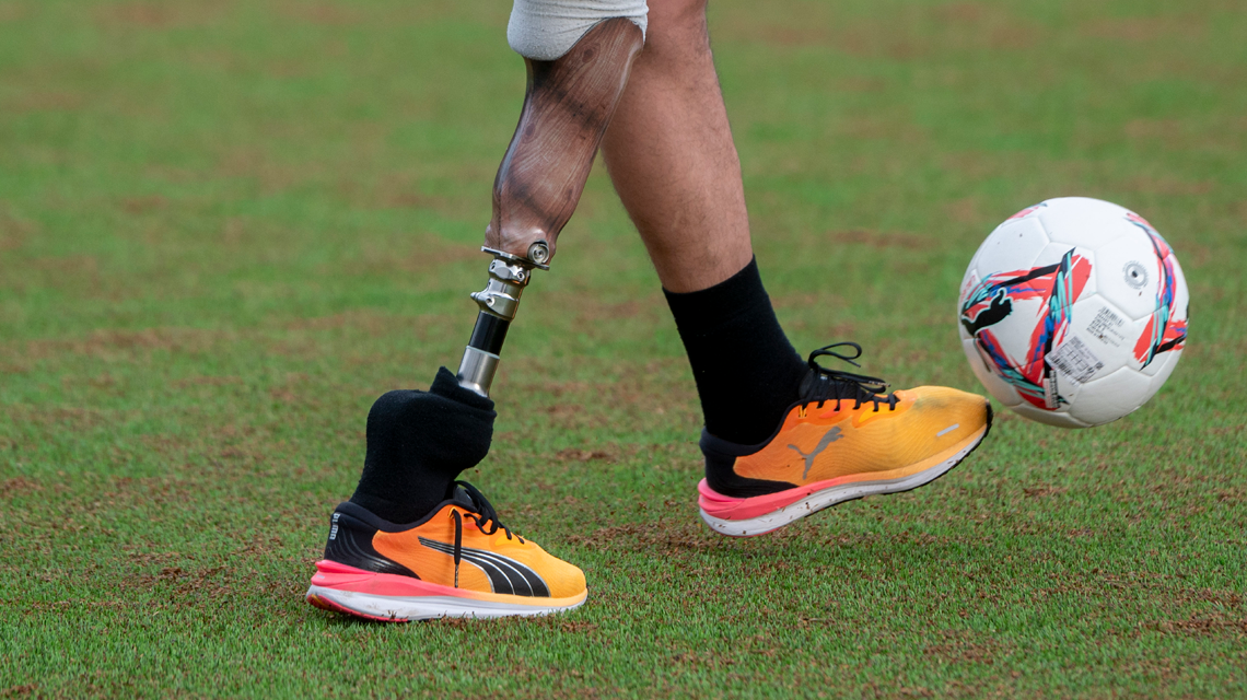 Jugador de fútbol con una pierna ortopédica
